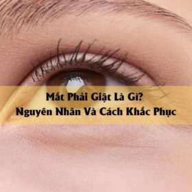 Mắt Phải Giật Là Gì Nguyên Nhân Và Cách Khắc Phục